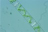 Spirogyra