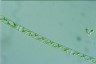 Spirogyra arta