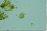 Choanocystis aculeata