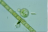 Choanocystis aculeata