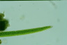 Closterium acerosum