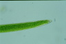 Closterium acerosum