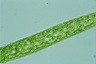 Pleurotaenium trabecula