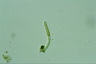 Ophiocytium parvulum