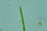 Closterium toxon