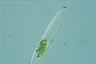 Tetmemorus granulatus