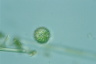 Choanocystis