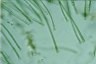 Rivularia globiceps