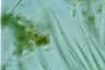 Rivularia globiceps
