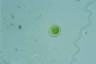 Dysmorphococcus punctatus