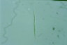 Monoraphidium griffithii