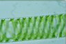 Spirogyra