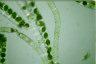 Spirogyra