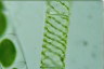 Spirogyra