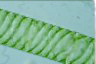 Spirogyra