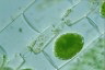 Spirogyra