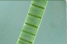 Spirogyra