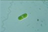 Cylindrocystis