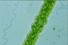 Pleurotaenium trabecula