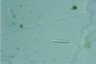 Vorticella