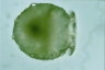 Difflugia urceolata