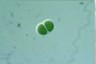 Chroococcus