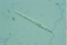 Cyclidiopsis acus