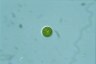 Haematococcus