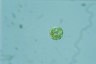 Haematococcus