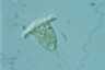 Vorticella nebulifera
