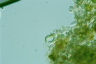 Ophiocytium parvulum