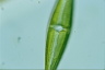 Stauroneis phoenicenteron