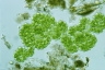 Botryococcus sudetica