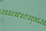 Spirogyra