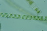 Spirogyra