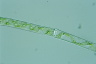 Spirogyra