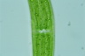 Closterium ehrenbergii