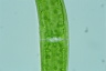 Closterium ehrenbergii