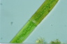 Closterium intermedium