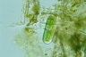 Cylindrocystis