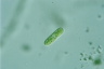 Cylindrocystis