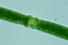 Pleurotaenium trabecula