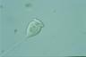 Vorticella