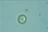 Acanthocystis