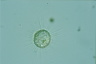 Acanthocystis