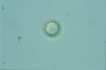 Acanthocystis