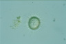 Acanthocystis