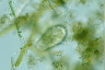 Euglypha acanthophora
