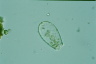 Euglypha strigosa