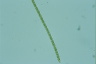 Anabaenopsis
